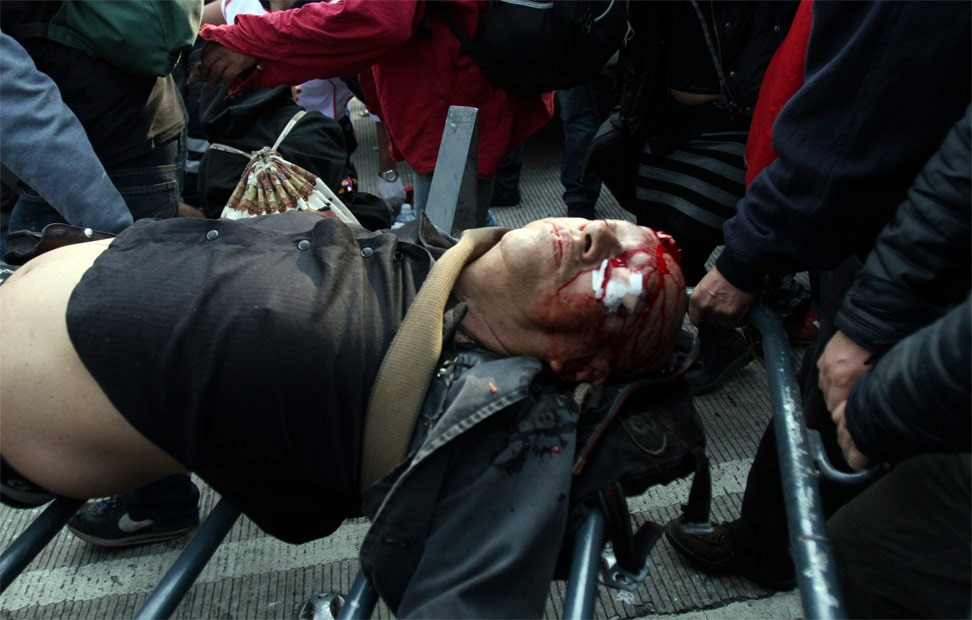 Uno de los heridos durante los enfrentamientos producidos en la protesta contra Peña Nieto.