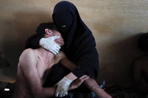 FOTO DEL AÑO. Una mujer sujeta en sus brazos a un familiar herido, dentro de una mezquita convertida en hospital de emergencia durante las protestas contra Saleh en Sanaa, Yemen.