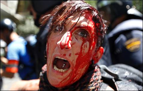 Una de las manifestantes heridas es retenida por la policía - AFP