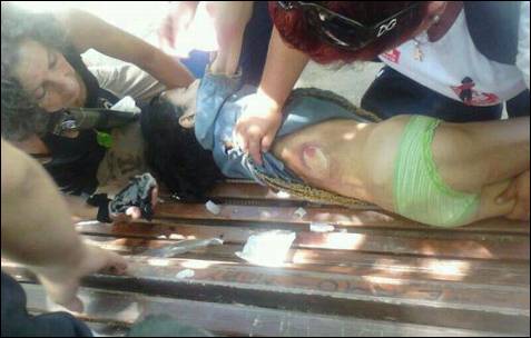 Una niña herida por una pelota de goma es auxiliada por manifestantes.
