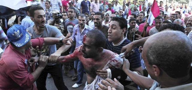 Un hombre egipcio ensangrentado tras los enfrentamientos entre los grupos de apoyo al presidente de Egipto, Mohamed Mursi y sus detractores, hoy, en Alejandría.EFE/Str
