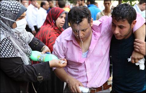 Los partidarios del depuesto presidente egipcio, Mohamed Mursi ayudan a un manifestante afectados por el gas lacrimógeno durante los enfrentamientos fuera de Al-Fath Mezquita en la plaza de Ramsés.