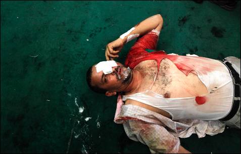 Un partidario de Mursi herido, dentro de una mezquita en la plaza Ramses en El Cairo.