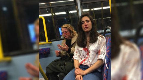 Una pareja de lesbianas fue agredida en un autobús en Londres por cuatro hombres. / FACEBOOK - MELANIA GEYMONAT