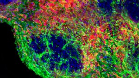 Microentorno, el ecosistema olvidado del cáncer