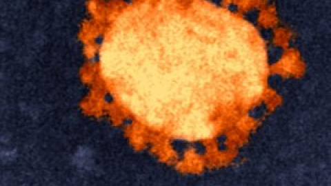 El coronavirus evidencia la carga sobre la mujer de los cuidados familiares