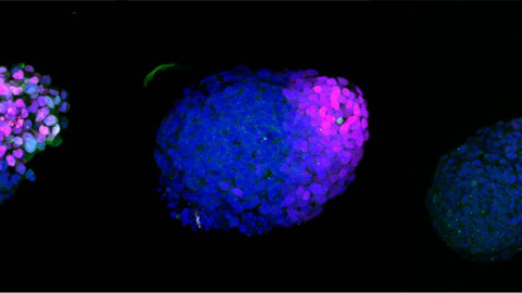 Gastruloide humano en crecimiento. 24h (izquierda), 48h (centro) y 72h (derecha) después de la agregación de células madre embrionarias (ESC). El azul marca el ADN, el magenta las células neurales (SOX2) y el verde las células mesodérmicas (BRA). / 