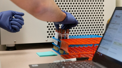 Francisco Soto, asistente de investigación en la Universidad de Arizona, prepara muestras de sangre para la prueba de anticuerpos para la enfermedad por coronavirus (COVID-19) en Tucson, Arizona, EE. UU., 10 de julio de 2020. REUTERS / Cheney Orr