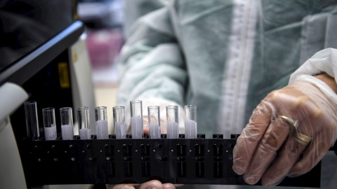 Un médico manipula unas muestras en un laboratorio, en una imagen de archivo. EFE/EPA/Julien de Rosa