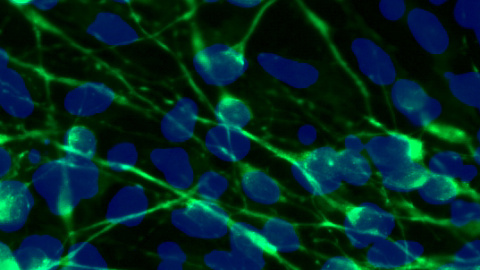 Neuronas normales tintadas para distinguir su cuerpo (en azul) de los axones (en verde)./SALK INSTITUTE