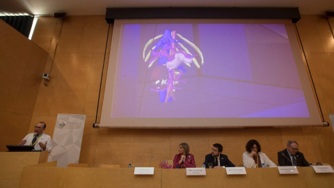 Presentació d'una tecnologia pionera a Espanya que utilitza un model anatòmic hologràfic en tres dimensions per a fer intervencions quirúrgiques d'alta complexitat. EFE/Marta Pérez