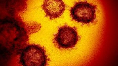 Las patentes ralentizan la vacuna del coronavirus