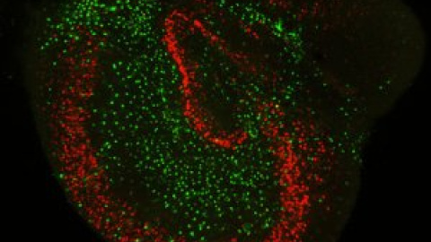 Así consigue el cerebro borrar los recuerdos no relevantes para sustituirlos por nuevos