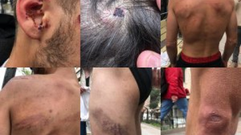 Uno de los jóvenes detenidos en Vallecas denuncia que dos guardias civiles le han dado "una paliza" en los juzgados