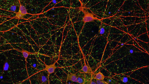 Imágenes de microscopía de cultivos de células neuronales. IBB-CSIC.