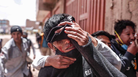 Manifestante resultan heridos tras enfrentamientos con la policía, hoy en Juliaca (Perú).