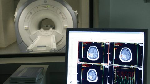 Vista d'un escàner a un centre de tractament d'Alzheimer, en una imatge d'arxiu