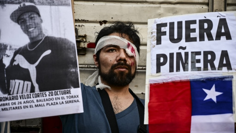 Un manifestante con un ojo vendado sostiene un cartel que dice 'Piñera fuera' durante una manifestación contra el presidente chileno Sebastián Piñera en Buenos Aires, el 5 de noviembre de 2019, mientras Chile sufre el peor brote de malestar social en 