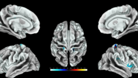 Así responde el cerebro femenino a la estimulación genital