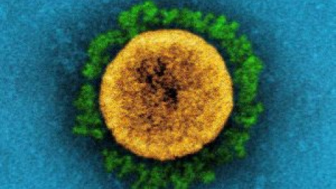 Principia Marsupia - Qué significa que la covid pase de pandemia a endemia