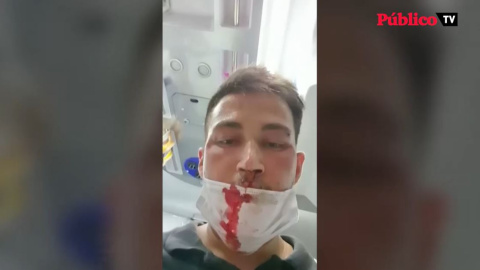 Un joven brasileño denuncia la agresión homófoba de un compañero de trabajo en Sanlúcar de Guadiana, Huelva