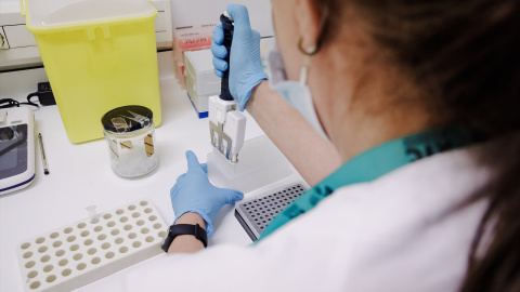 Imagen de archivo de una técnico de laboratorio preparando una PCR para el análisis de la viruela del mono.