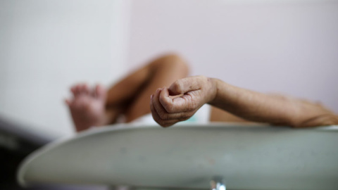 Los brazos de un niño yemení en estado de desnutrición en el hospital Al-Sabeen hospital in Saná. (REUTERS)