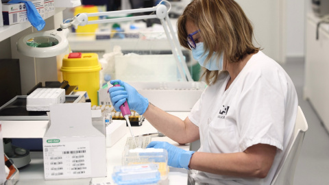 31/05/2022-Una técnico de laboratorio trabaja con pruebas PCR para detectar la viruela del mono en el Laboratorio de Microbiología del Hospital público Gregorio Marañón, a 31 de mayo, en Madrid