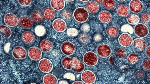 09/08/2022. Una micrografía electrónica de transmisión de partículas del virus de la viruela símica, a 4 de agosto de 2022.