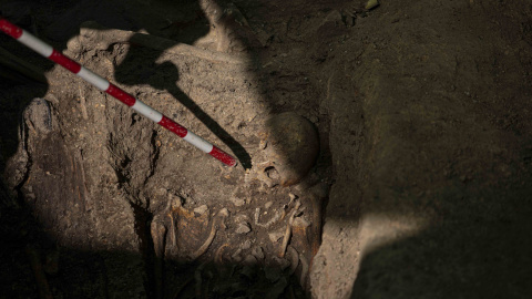 Un segundo cráneo con un puente de oro en la dentadura, aún por confirmar si es de unos de los fusilados en Colmenar Viejo en 1939.