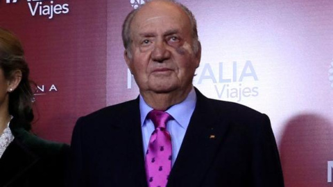 El rey emérito Juan Carlos, con un moratón y el apósito debajo del ojo | EFE