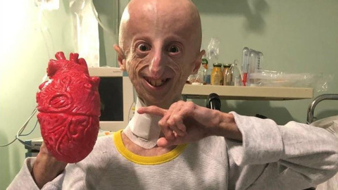 El biólogo molecular y enfermo de progeria, Sammy Basso (Facebook / Sammy Basso)