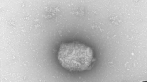 06/06/2022-Partículas virales del virus del mono observadas por microscopia electrónica de transmisión directamente del líquido obtenido de pústulas de pacientes infectados.