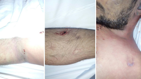 Imágenes facilitadas por la familia en el que se aprecian las presuntas pruebas de los malos tratos denunciados por la familia Fernández Imágenes facilitadas por la familia en el que se aprecian las presuntas pruebas de los malos tratos denunciados por la familia Fernández