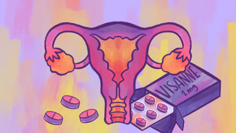 Ilustración sobre la endometriosis.