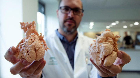 El jefe de sección de Cirugía cardiovascular del Hospital Materno Infantil de Málaga, Enrique Ruiz, muestra unos corazones de niños impresos a tamaño real en 3D. EFE/Jorge Zapata