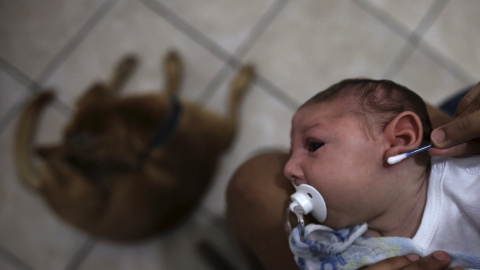 Daniele Santos, de 29 años, limpia el oído de su hijo Juan Pedro, que tiene 2 meses de edad y ha nacido con microcefalia, después de bañarlo en su casa en Recife, Brasil. El virus zika, transmitido por mosquitos, se ha generalizado en Brasi