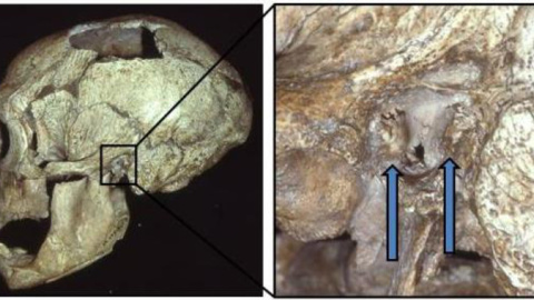 El cráneo de un hombre Neandertal con exóstosis (oído de nadador) / Erik Trinkaus