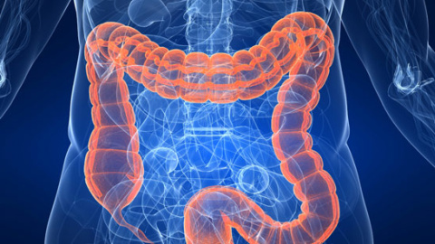 El cáncer de colon es de los más comunes en España, con 41.000 nuevos casos anuales