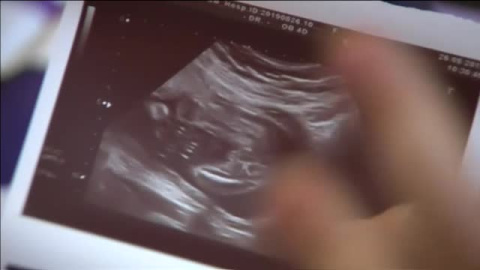 La listeriosis provoca tres nuevos abortos en las Ãºltimas horas