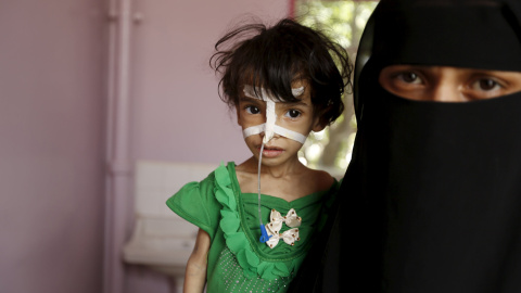 Una mujer coge en brazos a su hija desnutrida en un hospital en la capital de Yemen, Saná. La guerra en Yemen ha matado a más de 3.500 personas. UNICEF dice que la cifra de muertos incluye 365 niños. REUTERS / Khaled Abdullah