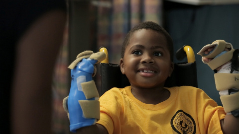 Zion Harvey, un niño de ocho años, tras recibir un trasplante de las dos manos a principios de este mes en Filadelfia, Estados Unidos. Harvey perdió sus manos y sus pies por una infección cuando tenía dos años. La operación duró 11 horas y 