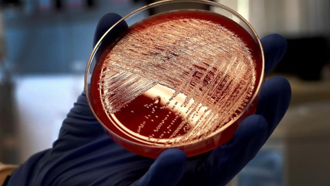 12/09/2019.- Vista de un cultivo de listeriosis en una placa de Petri, este jueves en el Laboratorio de Listeriosis del Centro Nacional de Microbiología de Madrid. Investigadores del Centro Nacional de Microbiología (CNM) han confirmado que