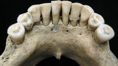 Pigmento de lapislázuli atrapado en el cálculo dental de la mandíbula inferior de una mujer medieval / Christina Warinner