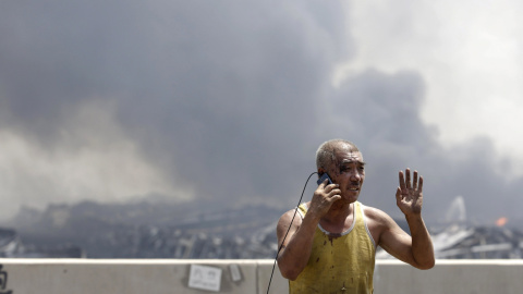 Un hombre herido habla por su teléfono móvil. De fondo, la columna de humo que ha dejado el incendio posterior a la explosión. REUTERS