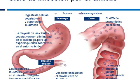 Ciclo de infección po Clostridium difficile