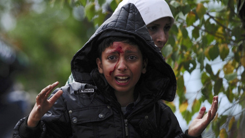 Un niño sirio herido en las cargas policiales contra los refugiados que tratan de cruzar la frontera entre Grecia y Macedonia.- REUTERS/Ognen Teofilovski