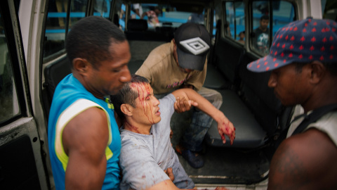 Un refugiado herido en el centro de detención de la Isla de Manus es llevado en brazos tras ser herido en un ataque de un grupo de hombres de Papúa Nueva Guinea. REUTERS