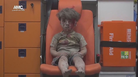 Omar Daqneesh, niño sirio superviviente de un bombardeo, se ha convertido en la imagen de la guerra siria/TWITTER