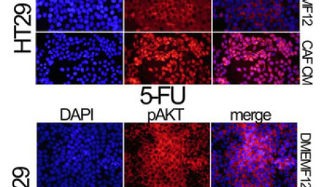 La localización de pAKT, una proteína crucial en el ciclo celular de células con daños en su ADN, analizada por inmunofluorescencia. / IDIBELL